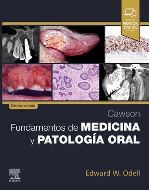 CAWSON.FUNDAMENTOS DE MEDICINA Y PATOLOGIA ORAL