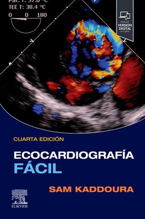 ECOCARDIOGRAFIA FACIL +STUDENT CONSULT