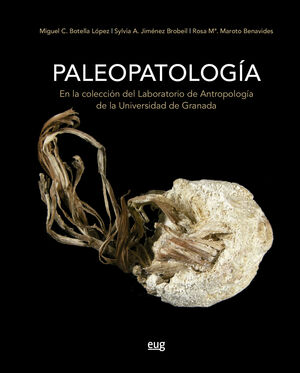 PALEOPATOLOGÍA EN LA COLECCIÓN DEL LABORATORIO DE ANTROPOLOGÍA DE LA UNIVERSIDAD