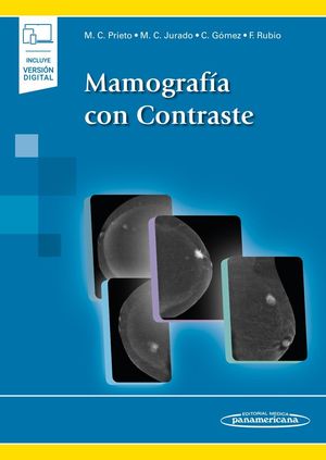 MAMOGRAFÍA CON CONTRASTE (EBOOK)